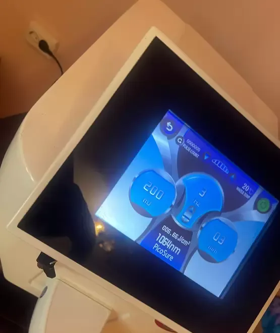 Laser pentru indepartarea pete tatuaje